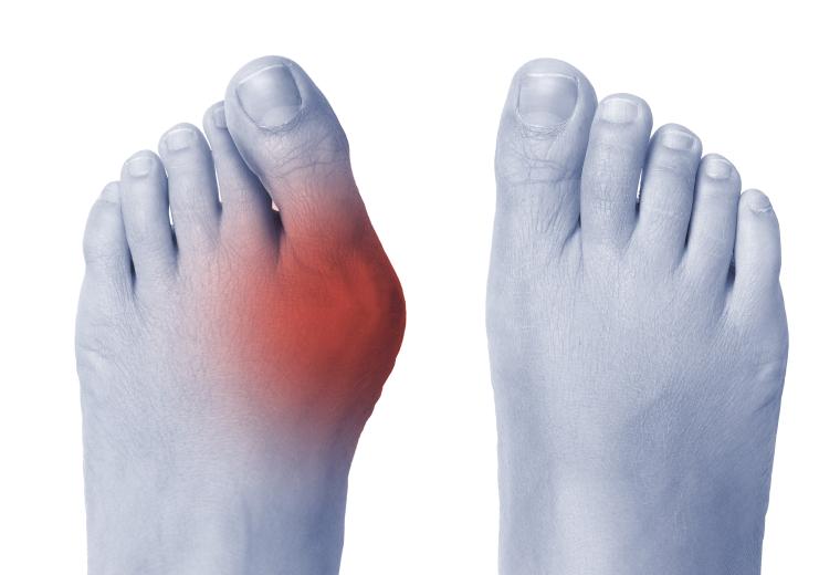 Chirurgie du pied et de la cheville